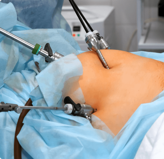 Laparoscopic Colorectal Surgery