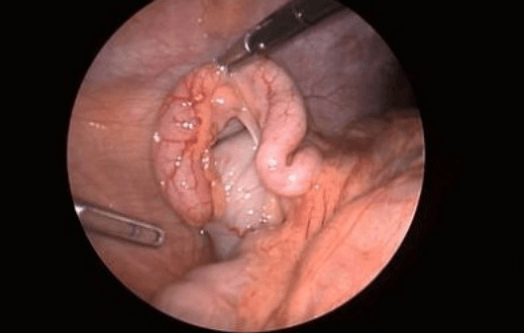 MEDICAL CONTENT FOR WEBSITE Copy11944